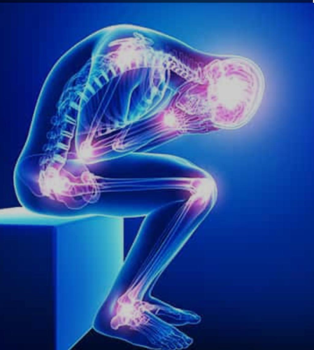 Fibromialgia