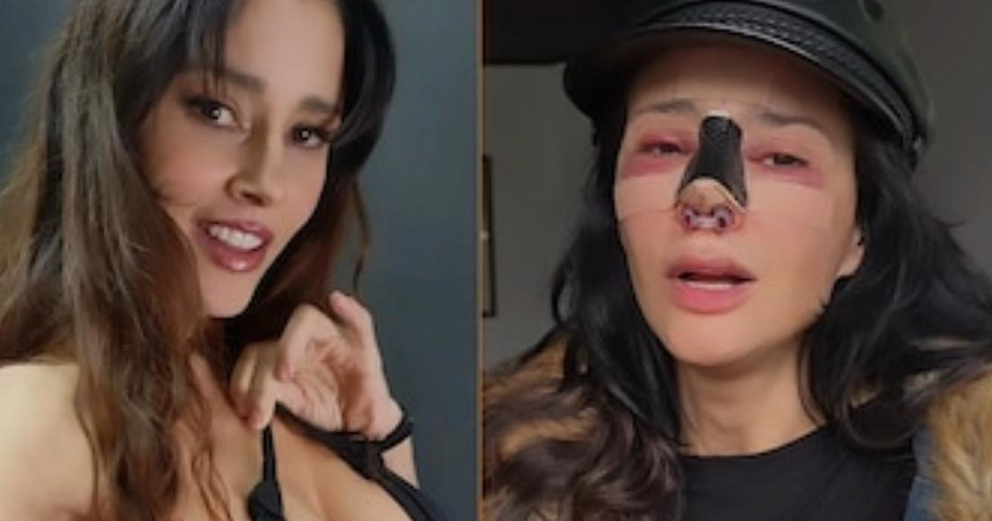 Dorismar y su operación fallida.