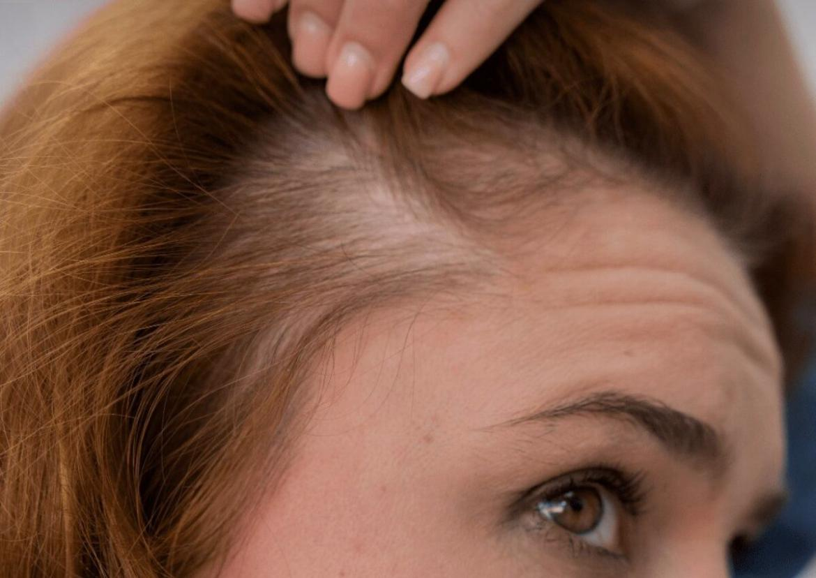 Evita la caída de cabello.