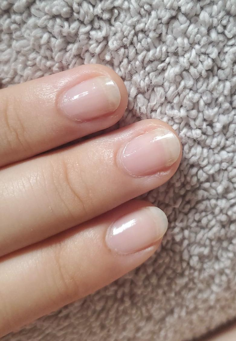 Las uñas crecen en un promedio de 3,47 milímetros al mes.