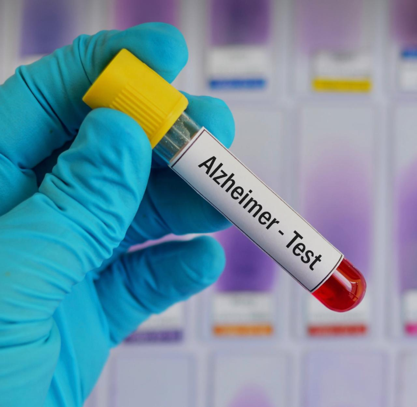 La prueba de sangre para el alzhéimer de Roche y Eli Lilly recibe autorización de la FDA